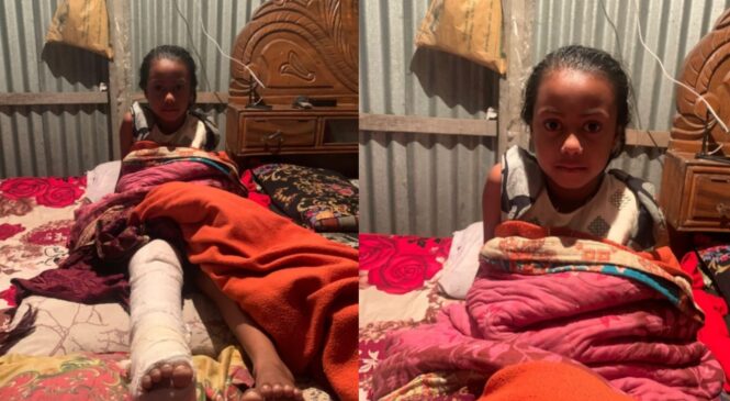 ত্রিশালে ৯ বছরের শিশু মুবিনার এক পায়ে অস্ত্রোপচার, সহায়তা চায় পরিবার